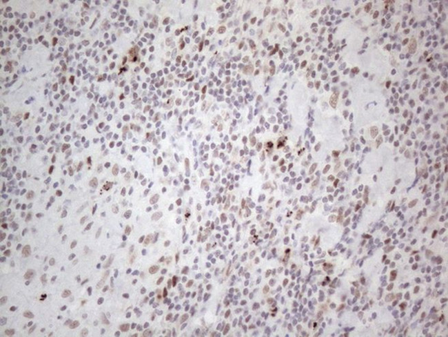 TP53BP1 Antibody in Immunohistochemistry (Paraffin) (IHC (P))