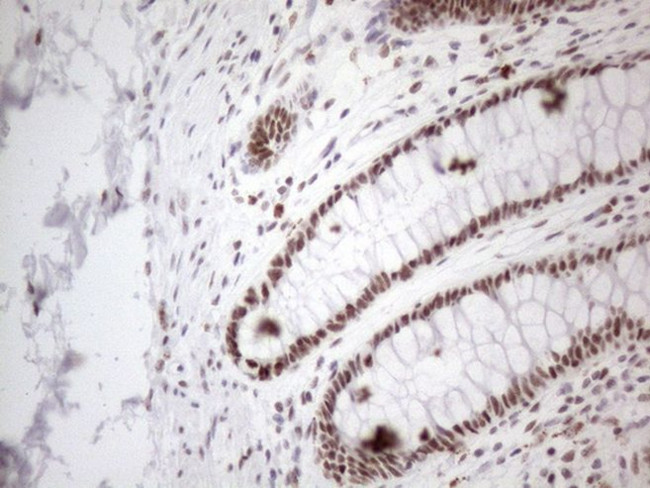 TP53BP1 Antibody in Immunohistochemistry (Paraffin) (IHC (P))