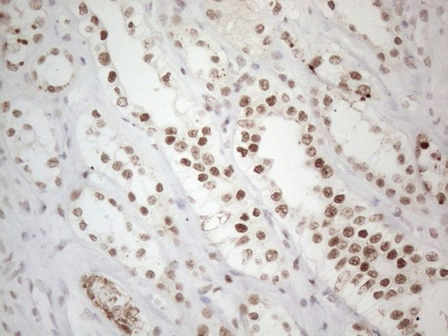 TP53BP1 Antibody in Immunohistochemistry (Paraffin) (IHC (P))