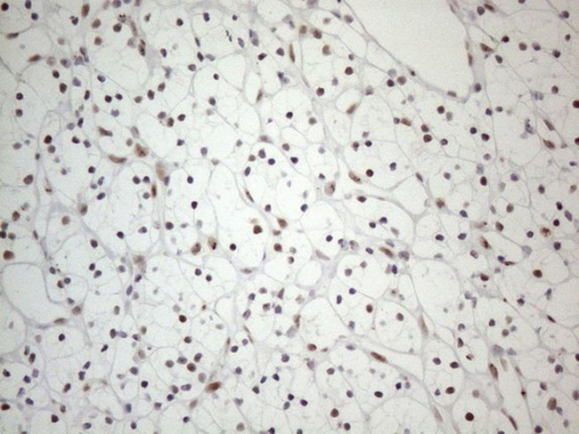 TP53BP1 Antibody in Immunohistochemistry (Paraffin) (IHC (P))