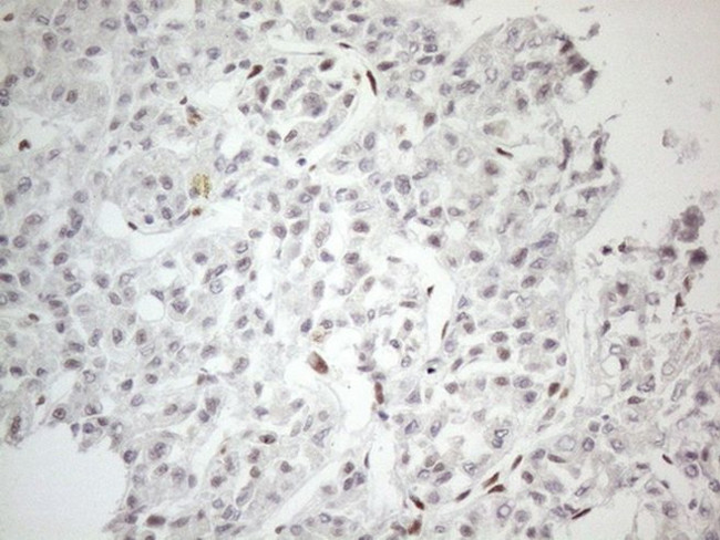 TP53BP1 Antibody in Immunohistochemistry (Paraffin) (IHC (P))