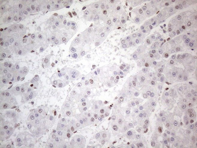 TP53BP1 Antibody in Immunohistochemistry (Paraffin) (IHC (P))