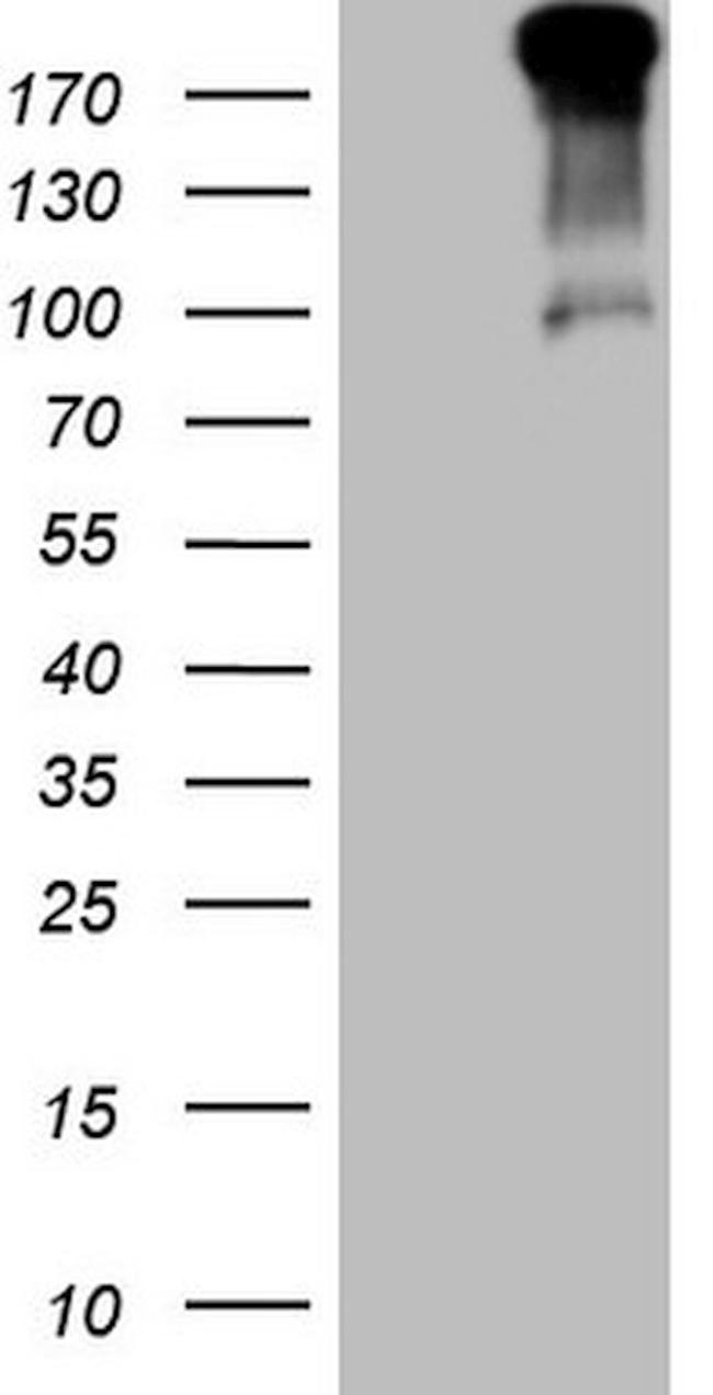 TP53BP1 Antibody in Western Blot (WB)