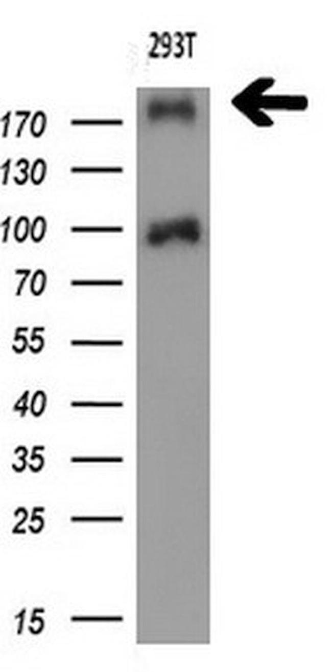 TP53BP1 Antibody in Western Blot (WB)