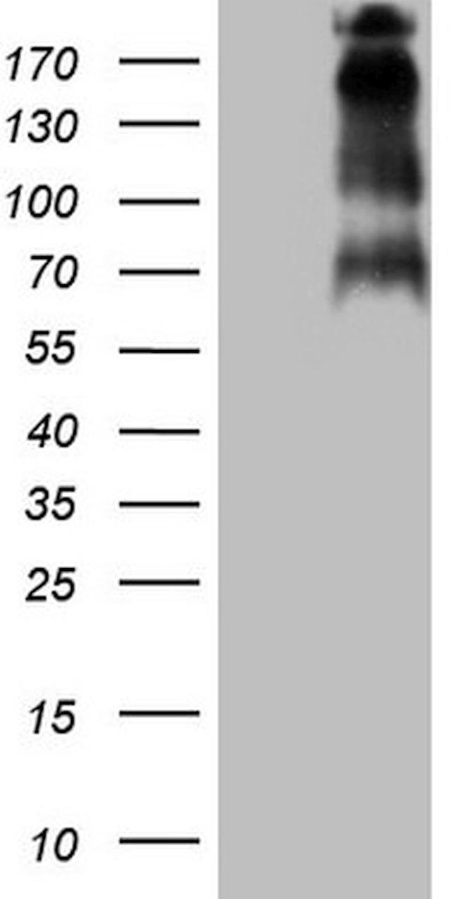 TP53BP1 Antibody in Western Blot (WB)