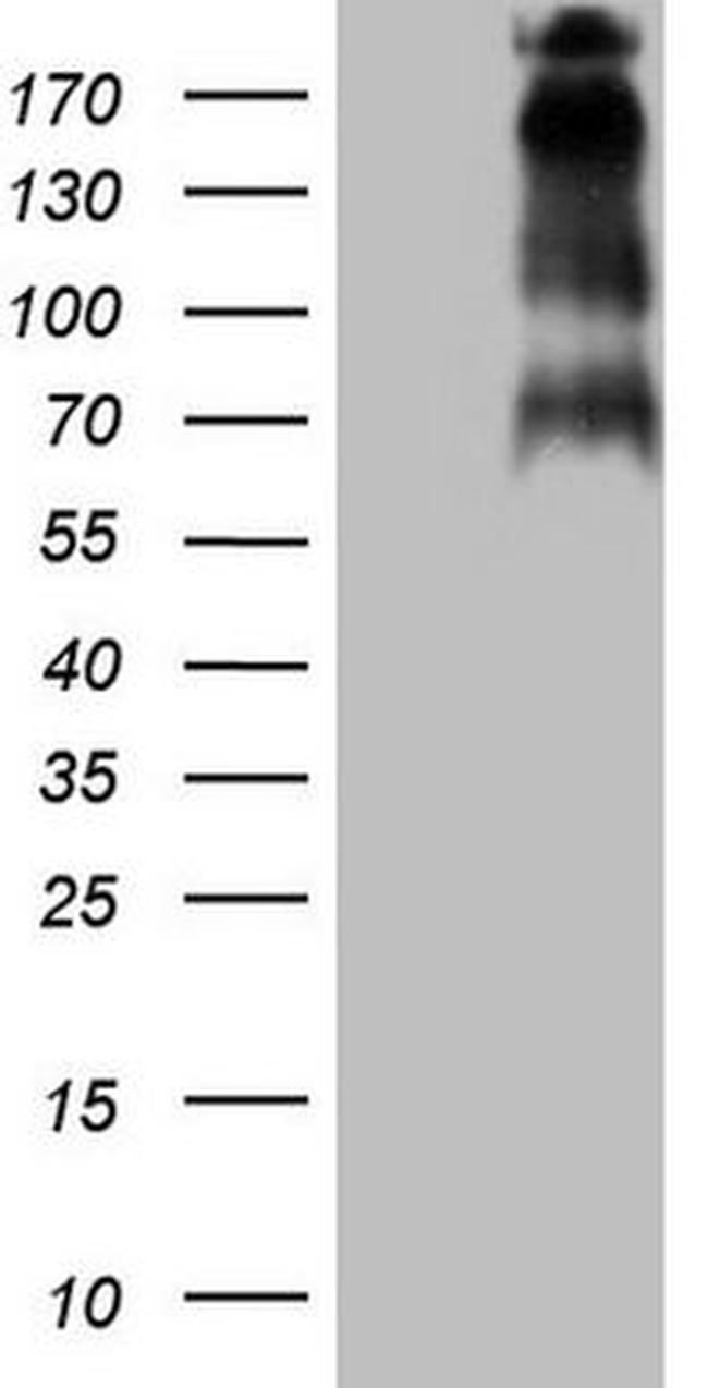 TP53BP1 Antibody in Western Blot (WB)
