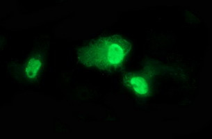 TP73 Antibody in Immunocytochemistry (ICC/IF)