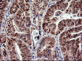 TP73 Antibody in Immunohistochemistry (Paraffin) (IHC (P))