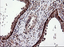 TP73 Antibody in Immunohistochemistry (Paraffin) (IHC (P))