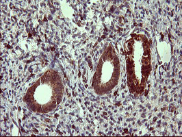 TP73 Antibody in Immunohistochemistry (Paraffin) (IHC (P))