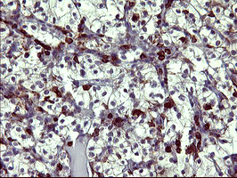 TP73 Antibody in Immunohistochemistry (Paraffin) (IHC (P))