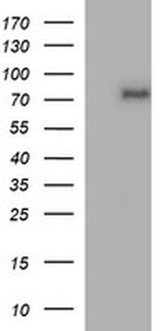 TP73 Antibody in Western Blot (WB)