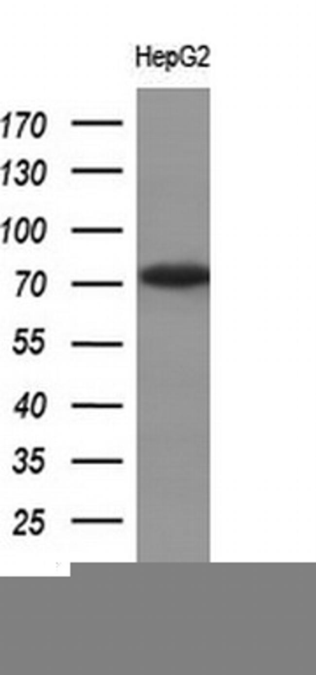 TP73 Antibody in Western Blot (WB)