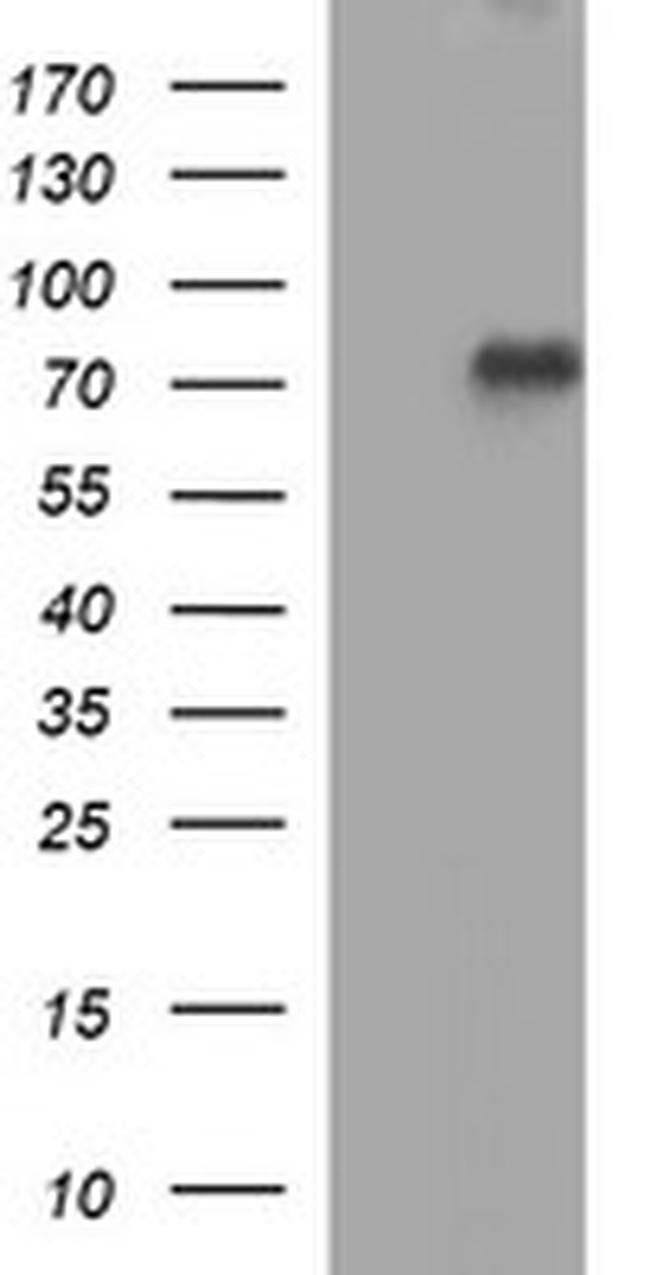 TP73 Antibody in Western Blot (WB)