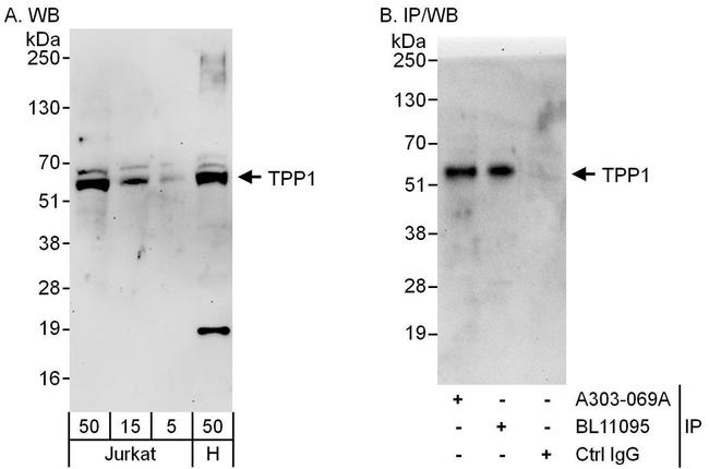 TPP1 Antibody in Western Blot (WB)