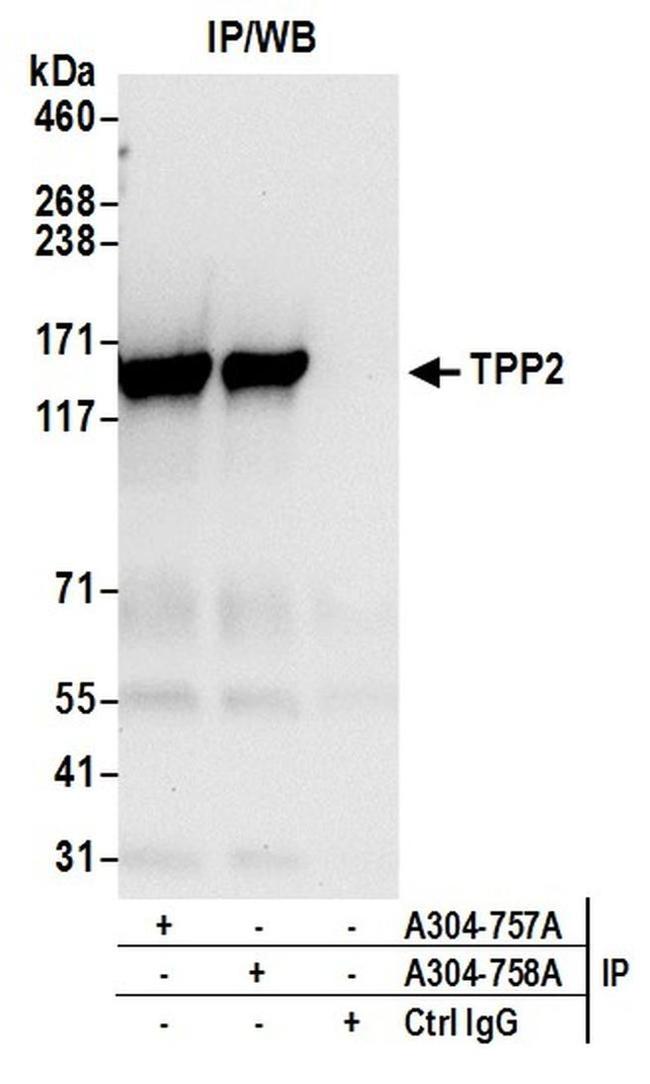 TPP2 Antibody in Western Blot (WB)