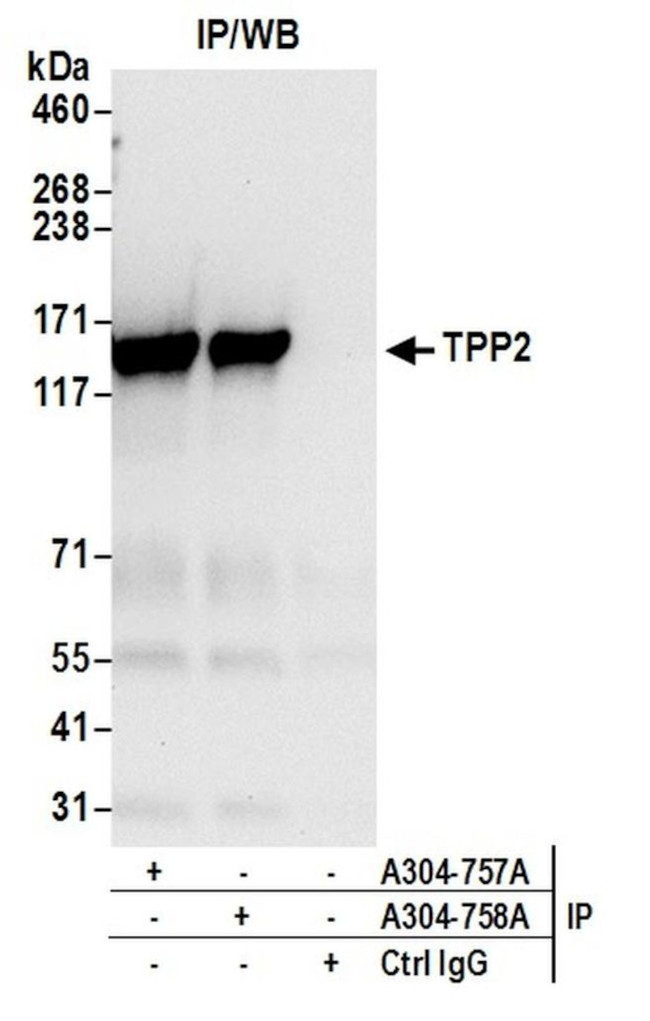 TPP2 Antibody in Immunoprecipitation (IP)