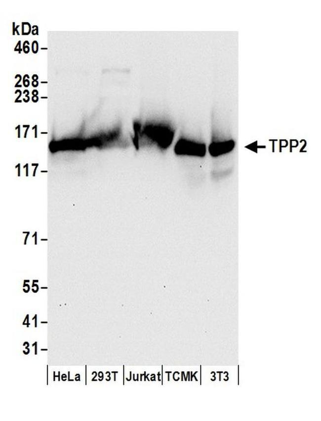 TPP2 Antibody in Western Blot (WB)