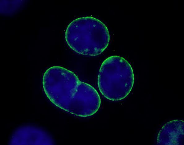 TPR Antibody in Immunocytochemistry (ICC/IF)