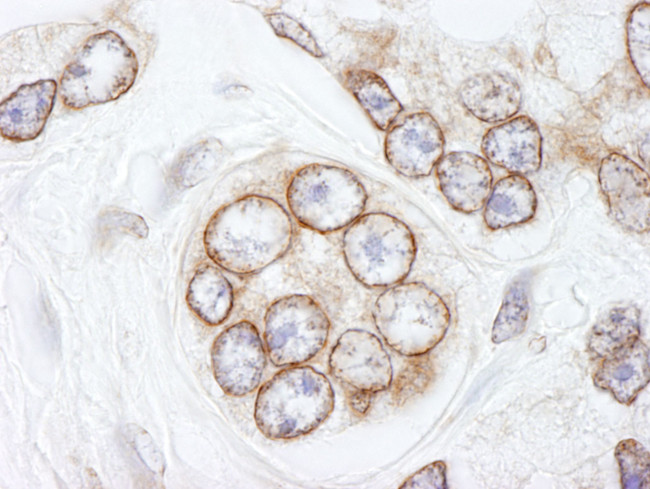 TPR Antibody in Immunohistochemistry (IHC)