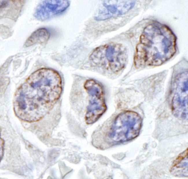 TPR Antibody in Immunohistochemistry (IHC)