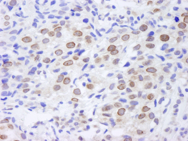 TPR Antibody in Immunohistochemistry (IHC)