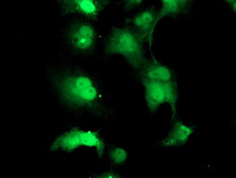 TPRKB Antibody in Immunocytochemistry (ICC/IF)