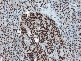 TPRKB Antibody in Immunohistochemistry (Paraffin) (IHC (P))