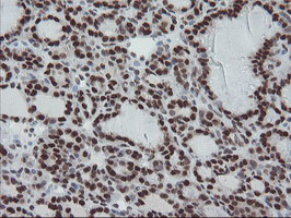 TPRKB Antibody in Immunohistochemistry (Paraffin) (IHC (P))