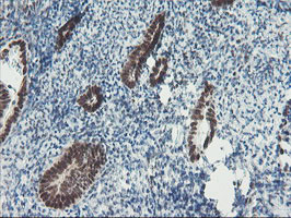 TPRKB Antibody in Immunohistochemistry (Paraffin) (IHC (P))