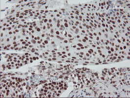 TPRKB Antibody in Immunohistochemistry (Paraffin) (IHC (P))