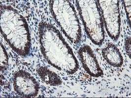 TPRKB Antibody in Immunohistochemistry (Paraffin) (IHC (P))