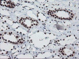 TPRKB Antibody in Immunohistochemistry (Paraffin) (IHC (P))