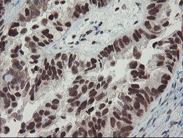 TPRKB Antibody in Immunohistochemistry (Paraffin) (IHC (P))