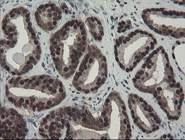 TPRKB Antibody in Immunohistochemistry (Paraffin) (IHC (P))