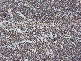 TPRKB Antibody in Immunohistochemistry (Paraffin) (IHC (P))