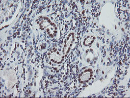 TPRKB Antibody in Immunohistochemistry (Paraffin) (IHC (P))