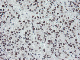 TPRKB Antibody in Immunohistochemistry (Paraffin) (IHC (P))