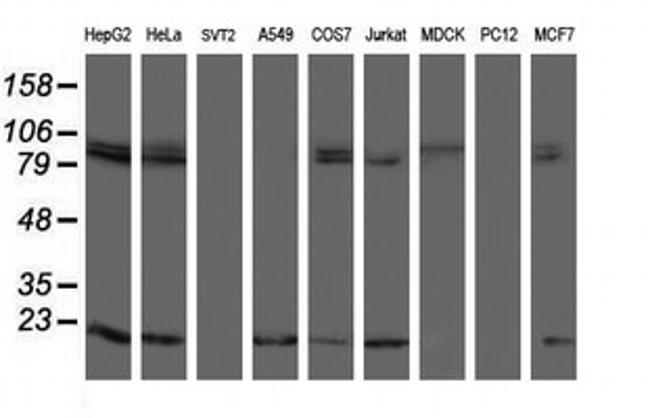 TPRKB Antibody in Western Blot (WB)