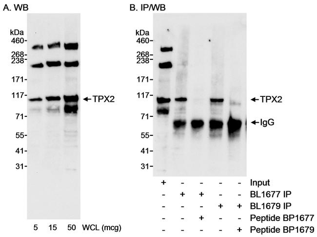 TPX2 Antibody in Western Blot (WB)