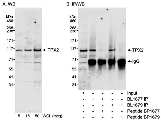 TPX2 Antibody in Western Blot (WB)