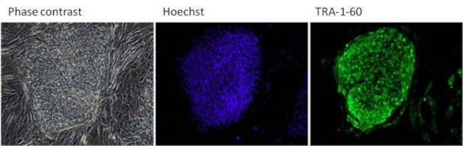 TRA-1-60 Antibody in Immunocytochemistry (ICC/IF)