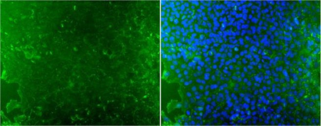 TRA-1-60 Antibody in Immunocytochemistry (ICC/IF)