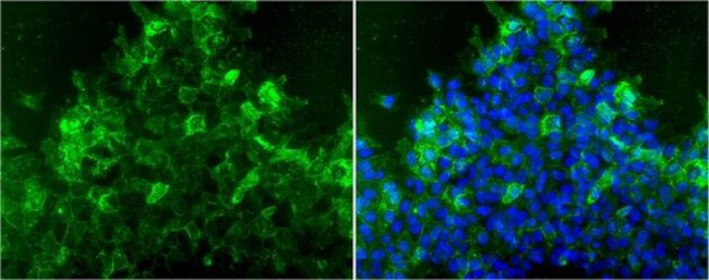 TRA-1-81 Antibody in Immunocytochemistry (ICC/IF)