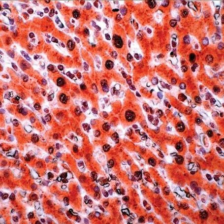 TRADD Antibody in Immunohistochemistry (IHC)