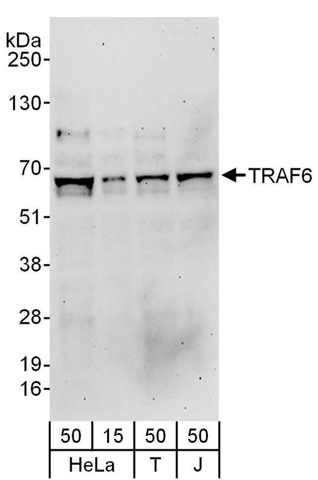 TRAF6 Antibody in Western Blot (WB)