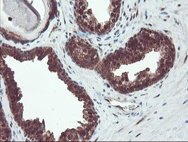 TRAIP Antibody in Immunohistochemistry (Paraffin) (IHC (P))