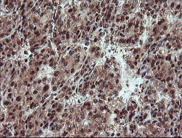 TRAIP Antibody in Immunohistochemistry (Paraffin) (IHC (P))