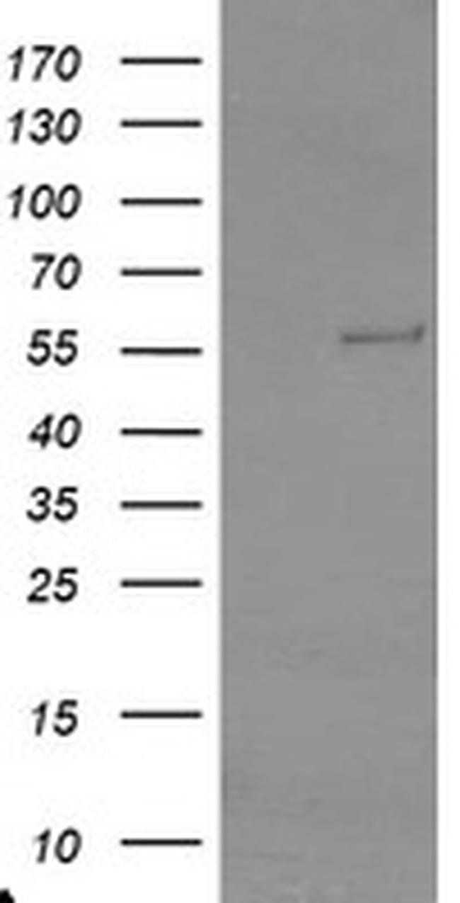 TRAIP Antibody in Western Blot (WB)