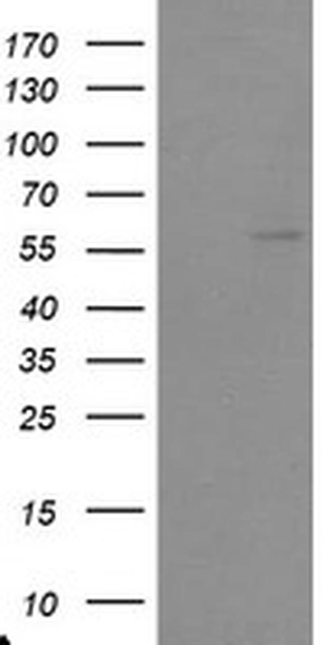 TRAIP Antibody in Western Blot (WB)